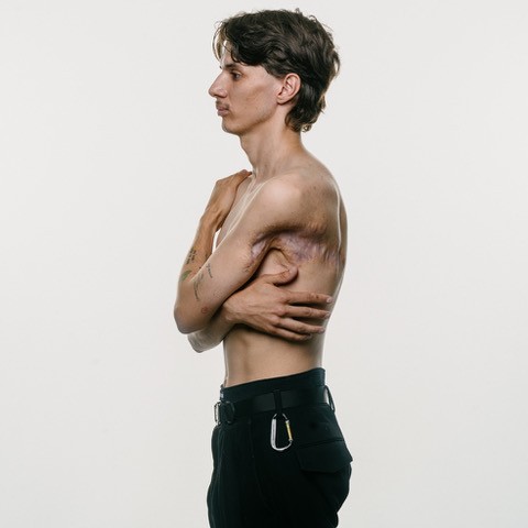 Images by photographer Giles Duley.